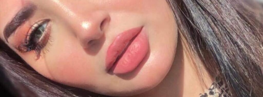Filler – Lippenvergrößerung & Konturbehandlungen